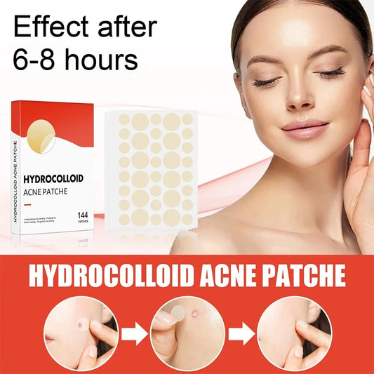 144pcs Acne Patches – Invisible Hydrocolloid Spot Stickers