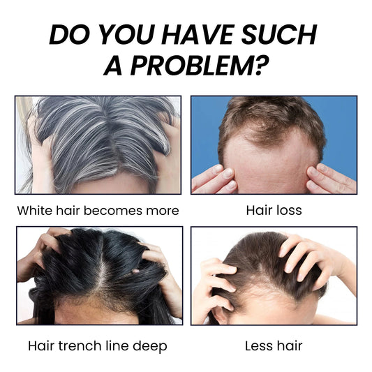 OUHOE Bamboo Charcoal Shampoo Soap – Deep Scalp Cleanse & Oil Control 60g - Roomsium