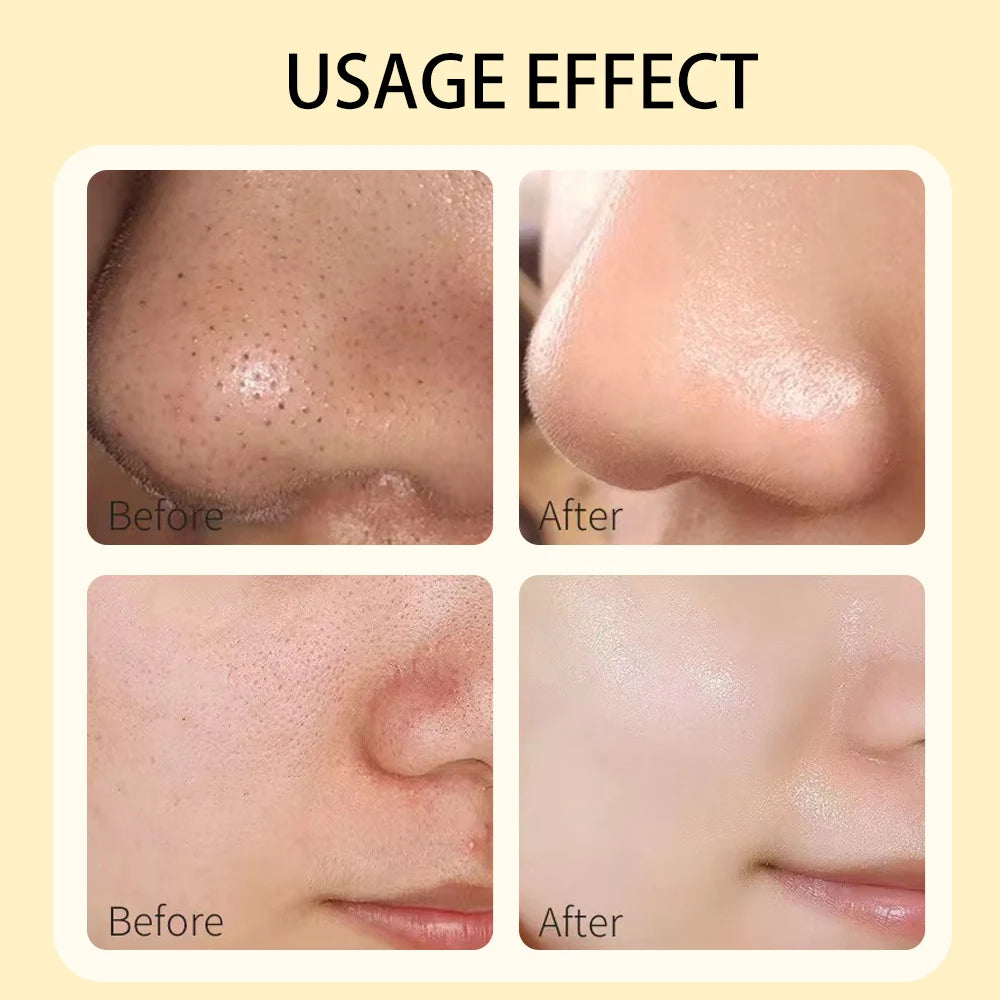 Turmeric Clay Mask Deep Cleansing Facial – Dark Spot & Acne Care, Oil Control