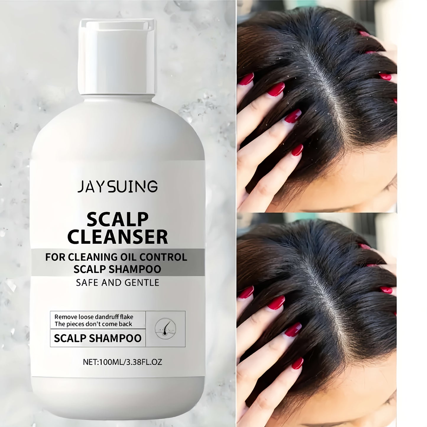 Scalp Repair Shampoo with Hyaluronic Acid – Dandruff Care Cleanser