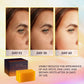Kojic Acid Brightening Soap – Handmade Dark Spot Cleansing & Moisturizing Facial Soap
