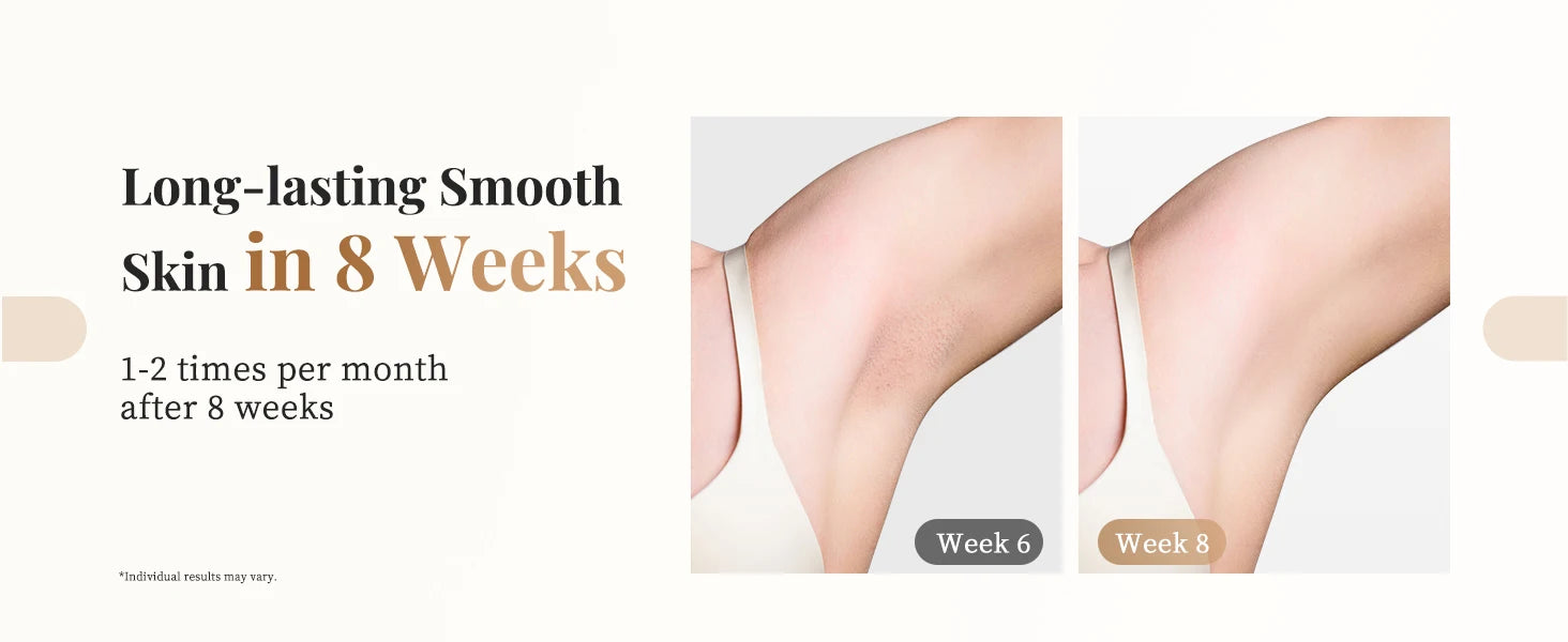 Totmizby 3-in-1 IPL Laser Hair Removal Device – Painless Home Epilator - Roomsium