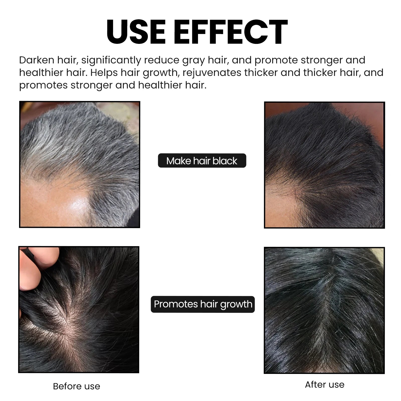 OUHOE Bamboo Charcoal Shampoo Soap – Deep Scalp Cleanse & Oil Control 60g - Roomsium