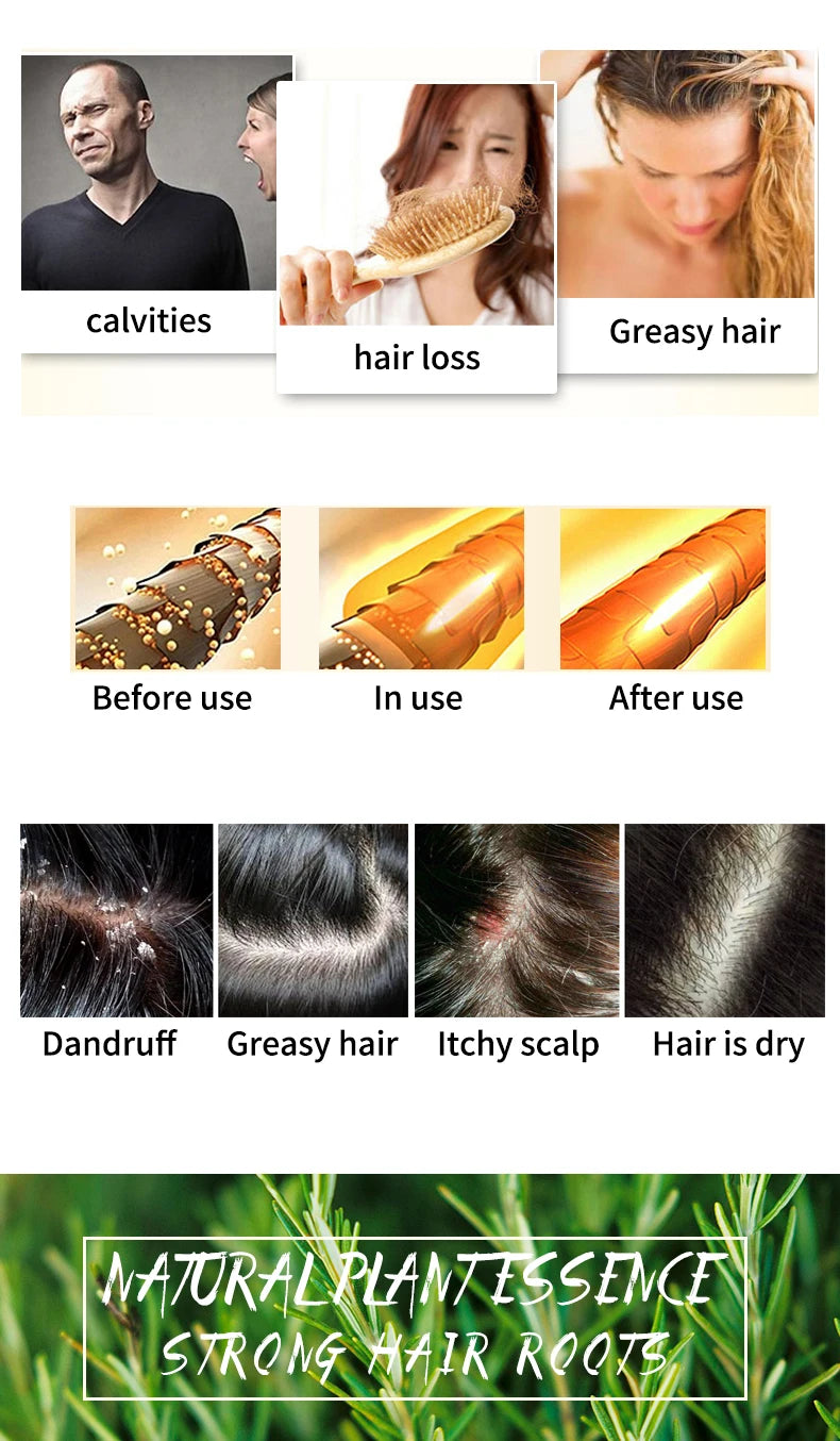 Rosemary Shampoo Bar 60g – Silicone-Free Solid Hair Cleanser