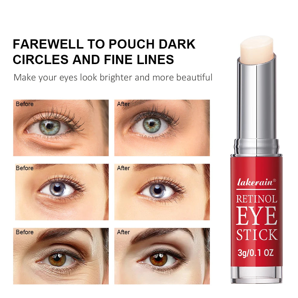 Retinol Eye Cream Stick | Dark Circle & Anti-Puffiness Eye Balm - Roomsium
