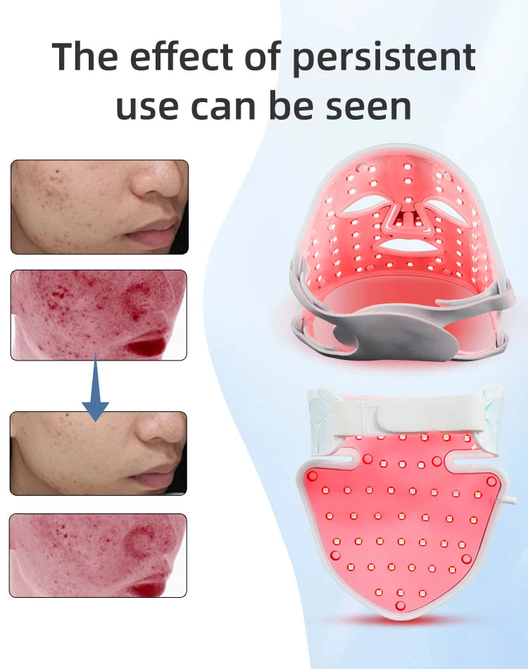 7-Color LED Face & Neck Mask with Infrared Light – Skin Rejuvenation & Anti-Aging Light Therapy