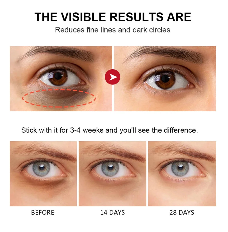 Retinol Eye Cream Stick | Dark Circle & Anti-Puffiness Eye Balm - Roomsium