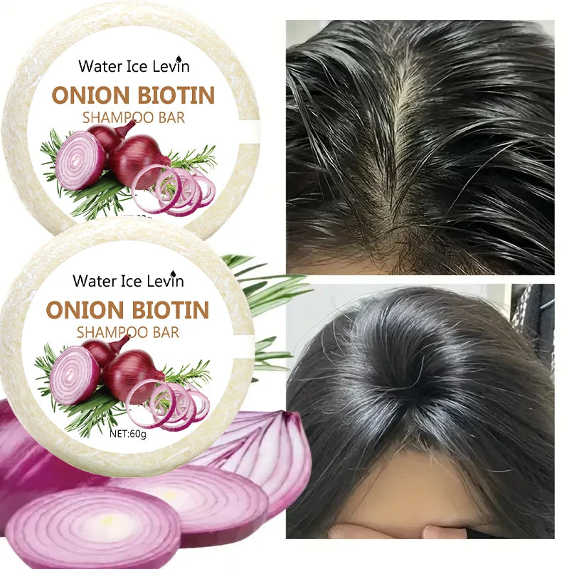 Onion & Biotin Shampoo Bar 60g – Rosemary-Infused Solid Hair Cleanser for All Hair Types - Roomsium
