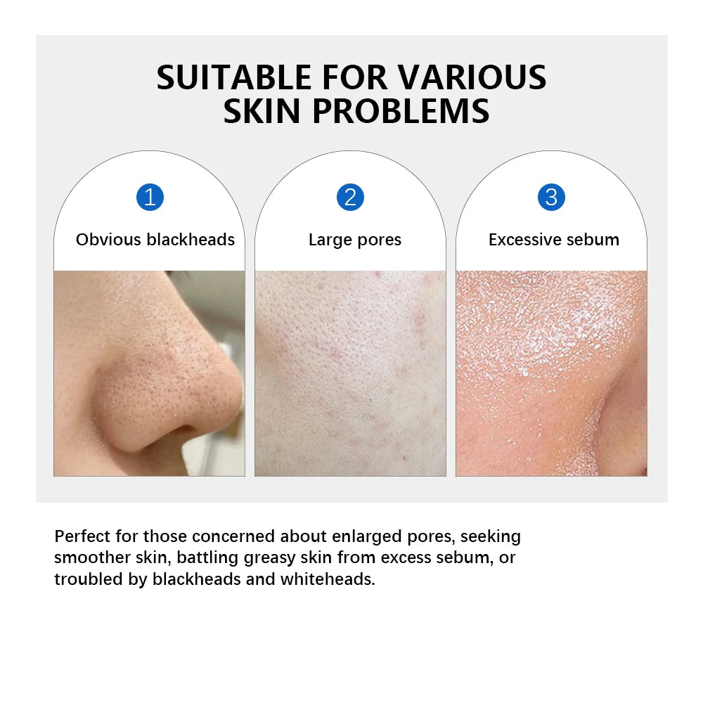 Zero Pore Pad 2.0 Double Textured Toner Pads – Exfoliating & Pore Refining (70pcs) - Roomsium