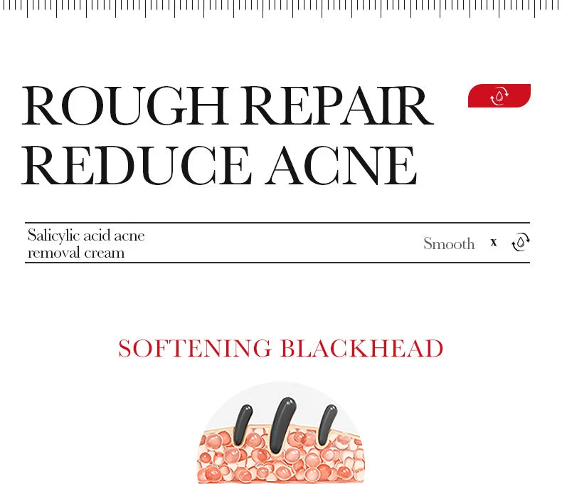BIOAQUA Salicylic Acid Acne Repair Face Cream – Blackhead & Mark Care, Moisturizing