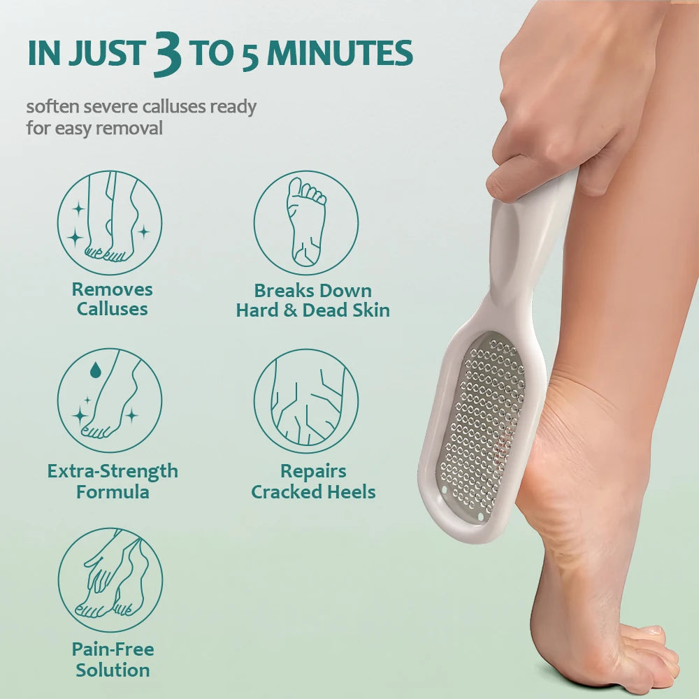 Nailpop Professional Callus Remover Kit – Extra Strength Foot Gel & Rasp File for Dry Cracked Heels - Roomsium