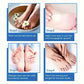 SUYARUN 60% Urea Foot Cream for Dry & Rough Skin