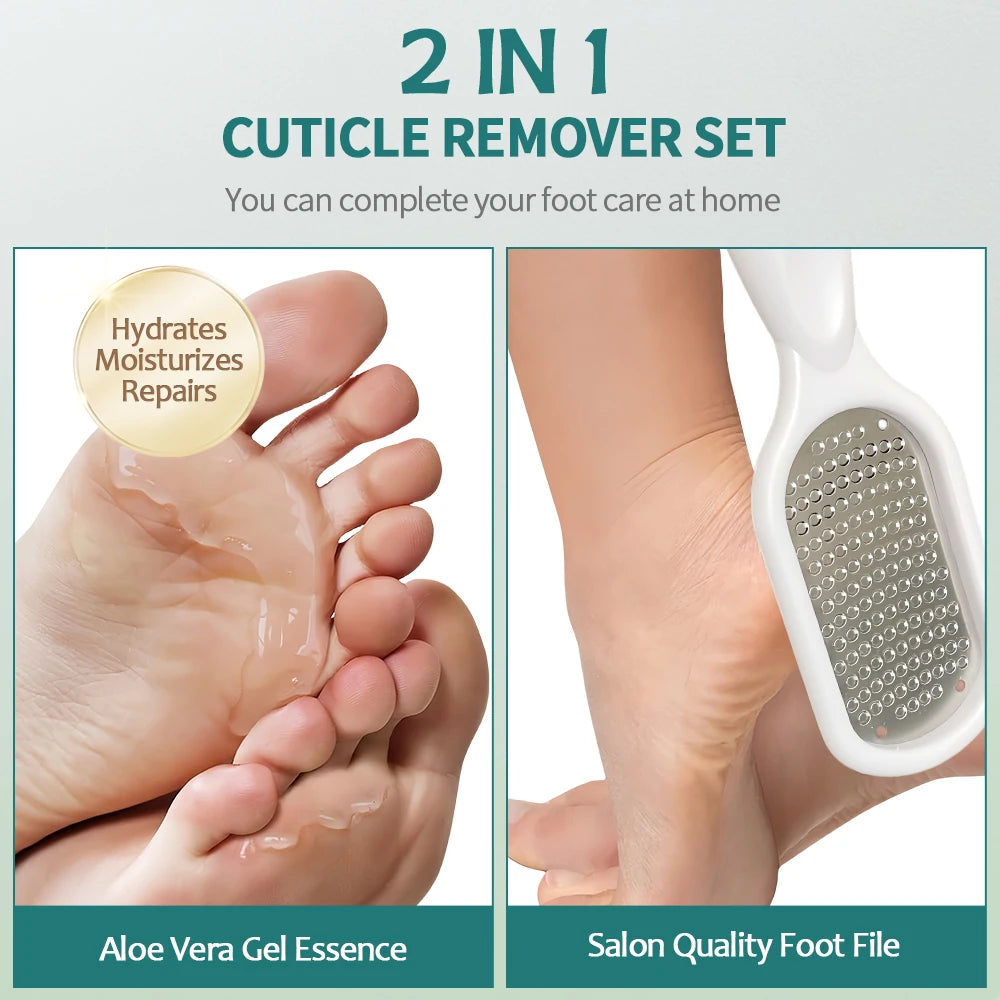 Nailpop Professional Callus Remover Kit – Extra Strength Foot Gel & Rasp File for Dry Cracked Heels - Roomsium