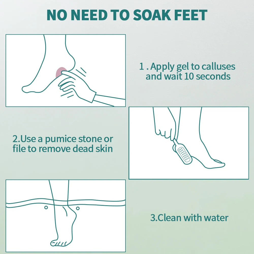 Nailpop Professional Callus Remover Kit – Extra Strength Foot Gel & Rasp File for Dry Cracked Heels - Roomsium