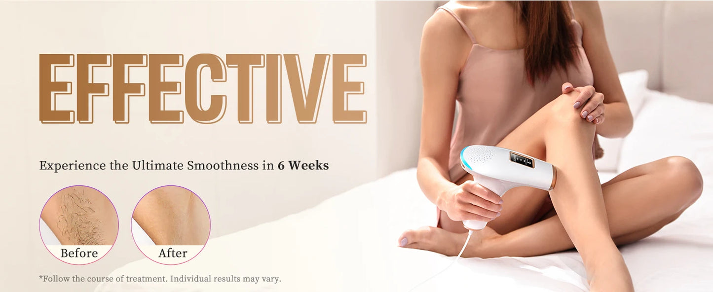 Totmizby 3-in-1 IPL Laser Hair Removal Device – Painless Home Epilator - Roomsium