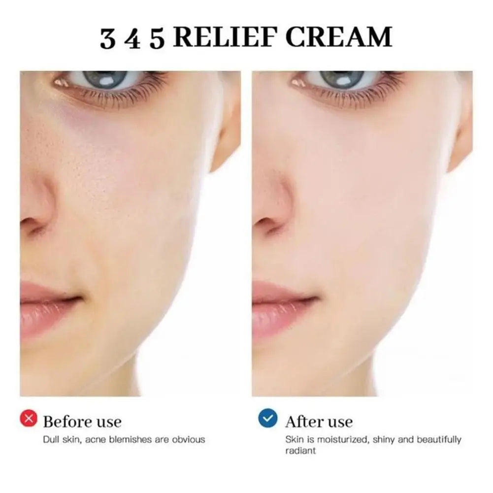 345 Relief Face Cream – Soothing & Hydrating Moisturizer for Oily Skin 50ml - Roomsium