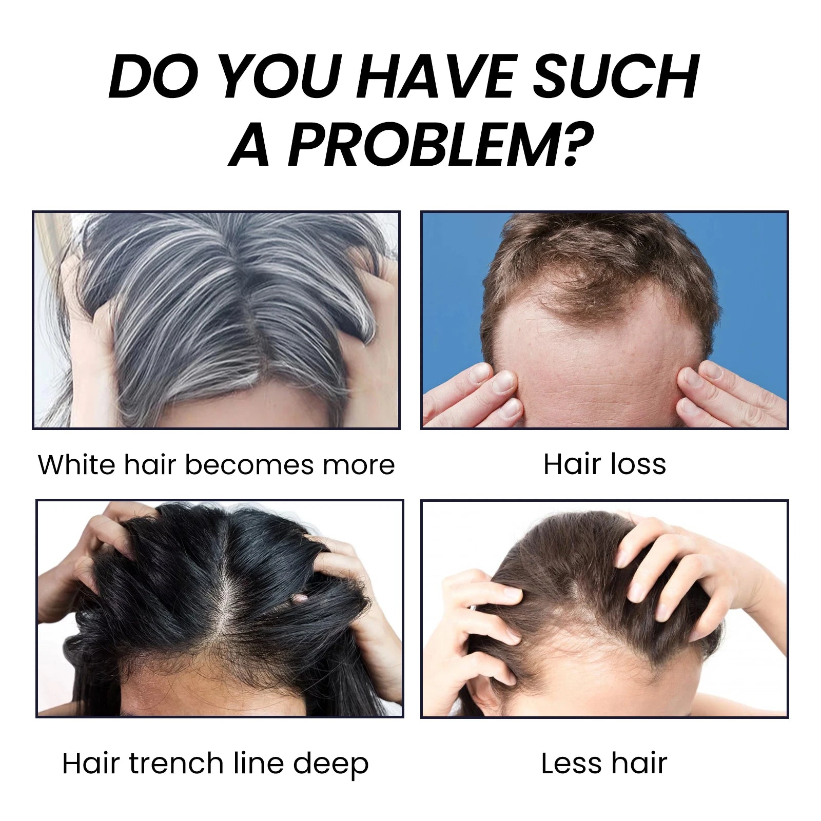 OUHOE Bamboo Charcoal Shampoo Soap – Deep Scalp Cleanse & Oil Control 60g - Roomsium