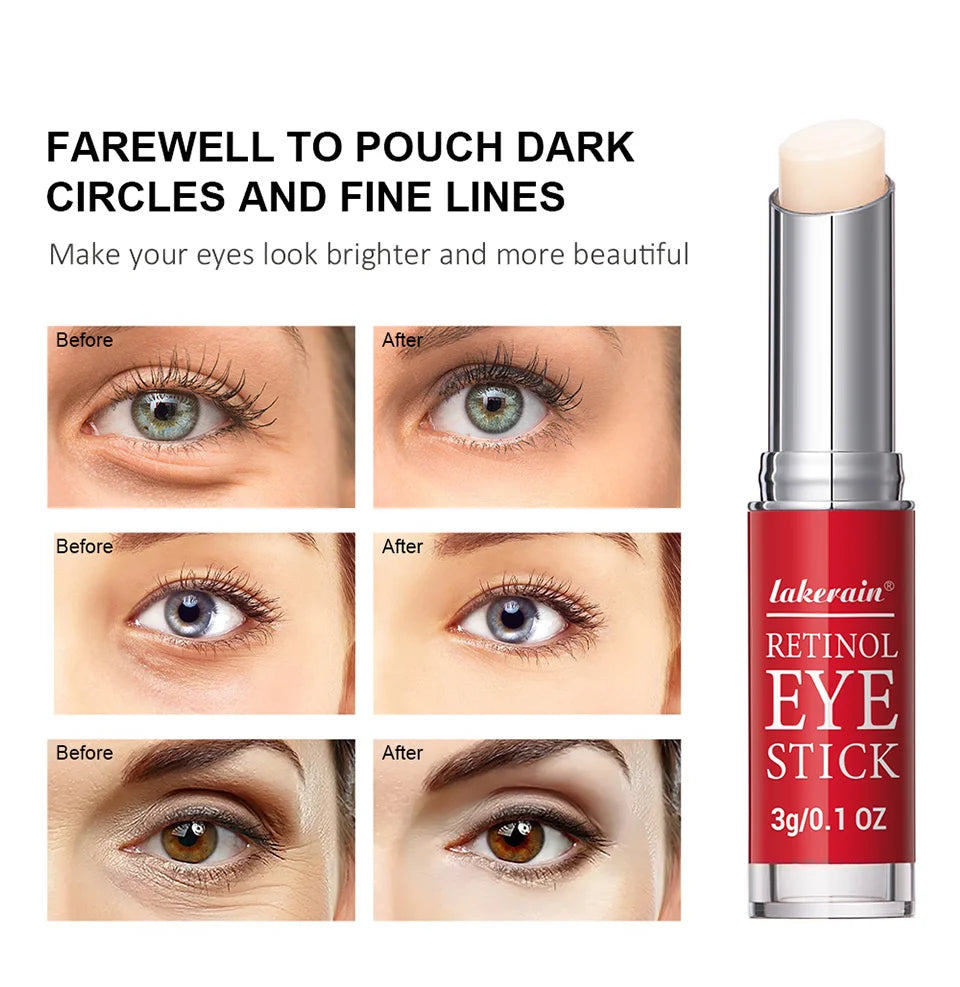 Retinol Eye Cream Stick | Dark Circle & Anti-Puffiness Eye Balm - Roomsium
