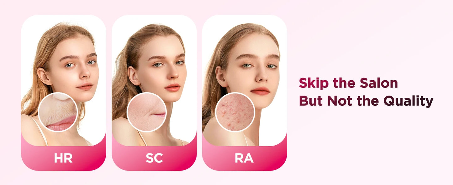 990,000-Flash IPL Hair Removal Device – At-Home Hair Reduction for Face & Body