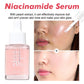 Niacinamide Brightening Serum 30ml – Dark Spot Care, Pore Refining & Skin Tone Balancing
