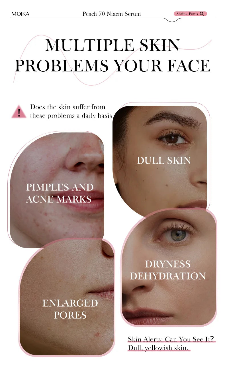 Niacinamide Brightening Serum 30ml – Dark Spot Care, Pore Refining & Skin Tone Balancing