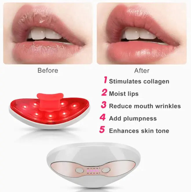 Lip Beauty Device LED Heating Portable - Roomsium